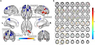 Abnormal brain activity in lumbar disc herniation patients with chronic pain is associated with their clinical symptoms